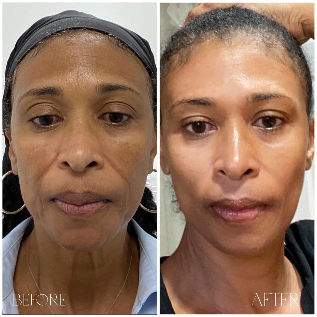 Lumévia™ Multi Collagen Complex